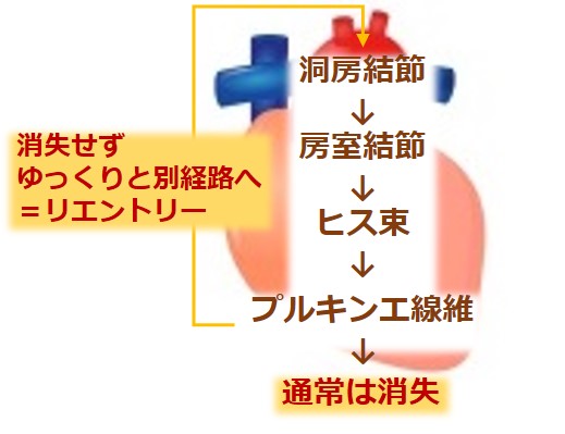 抗不整脈薬による低血糖症   jshp.or.jp